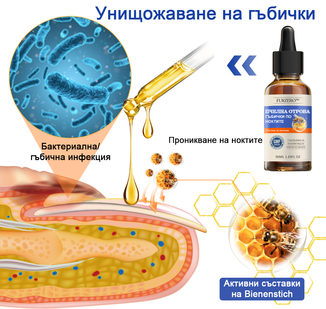 🐝Furzero™ Лечение на гъбички по ноктите с пчелна отрова: Пълно решение на проблема с гъбичките по ноктите🌟👣