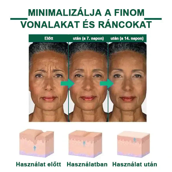 【✨utánvétel (COD)✨】Akció utolsó napja 80% kedvezmény - Fubsta™ Fiatalító és feszesítő bőrszérum🔥